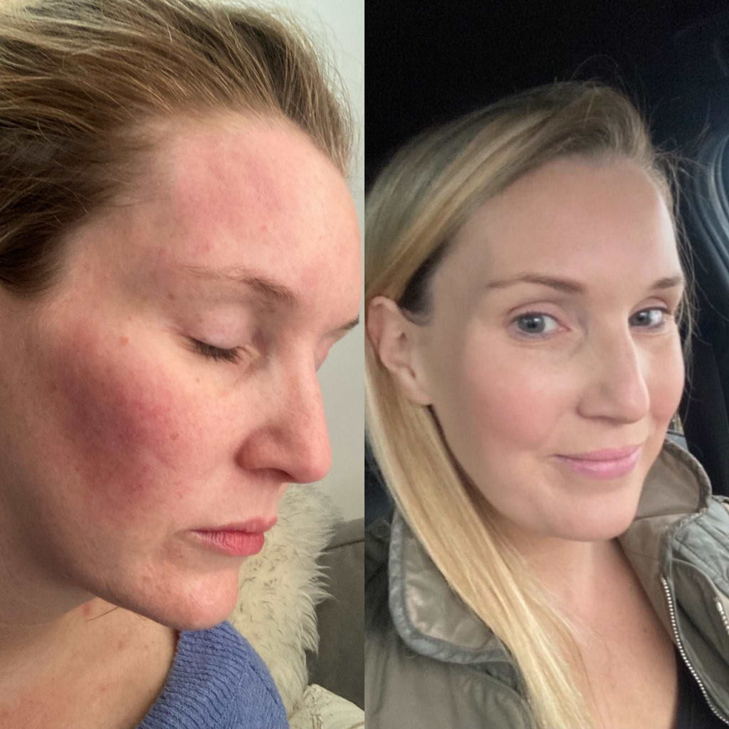 Lime & Coconut 2-in-1 Makeup Remover Cleansing Water - 200ml